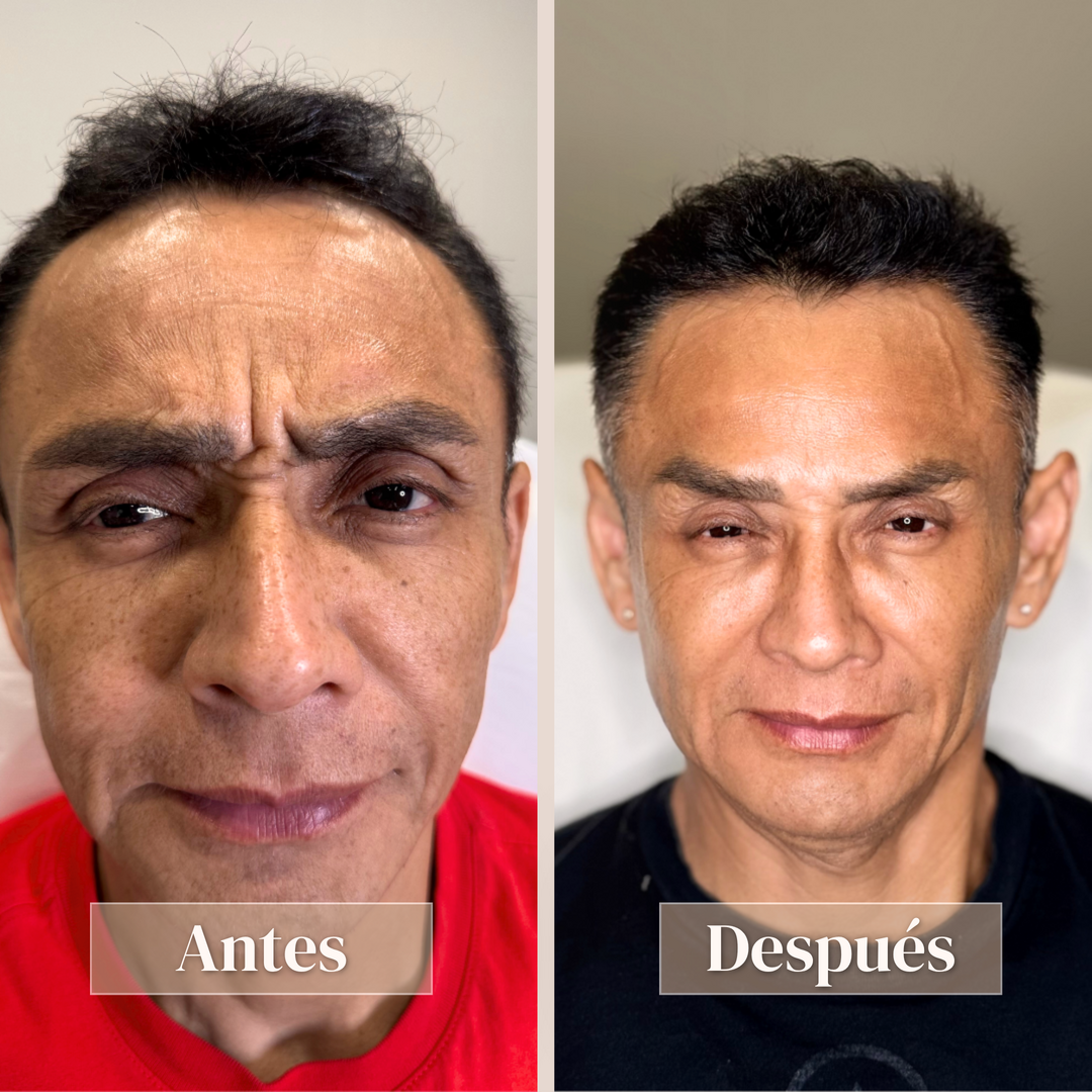 Full face - Vista 3