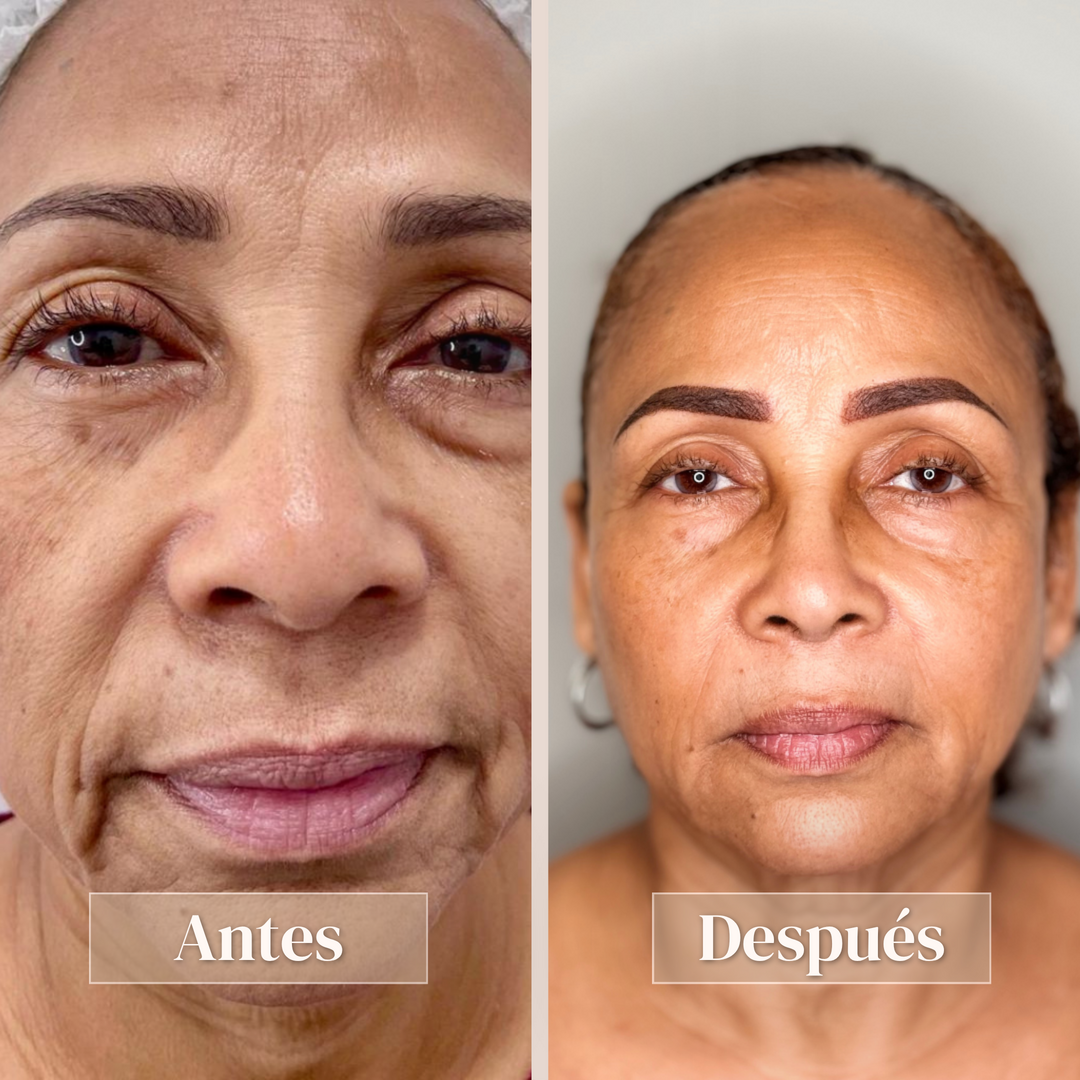 Full face - Vista 1