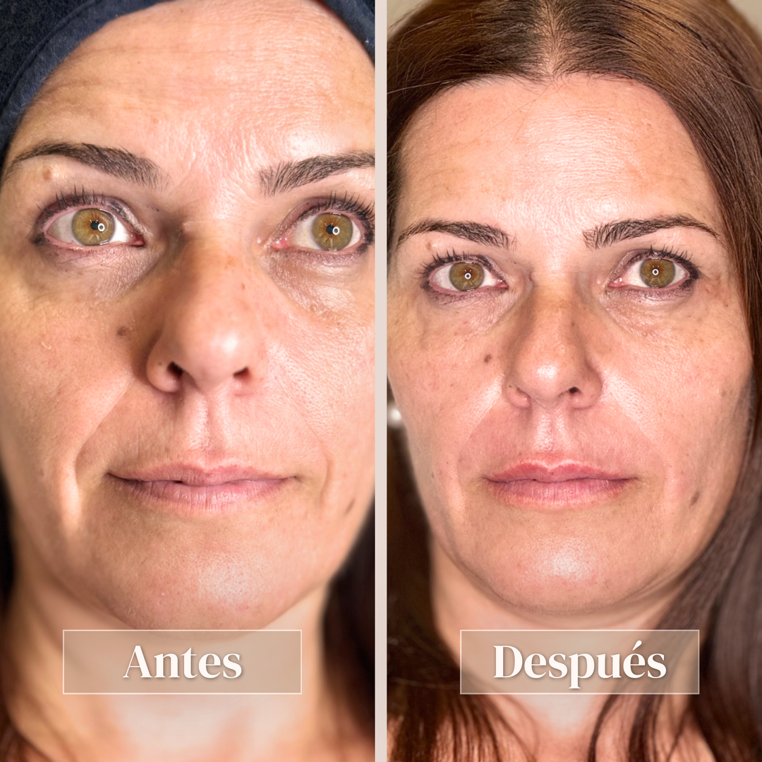 Full face - Vista 2