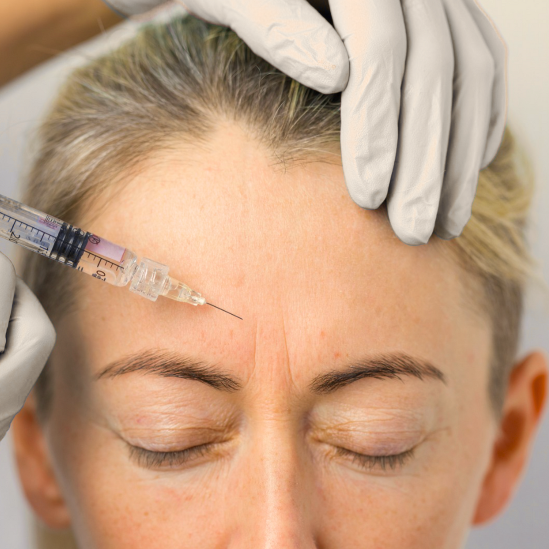 Profesional evaluando el rostro de una mujer para tratar arrugas de expresión