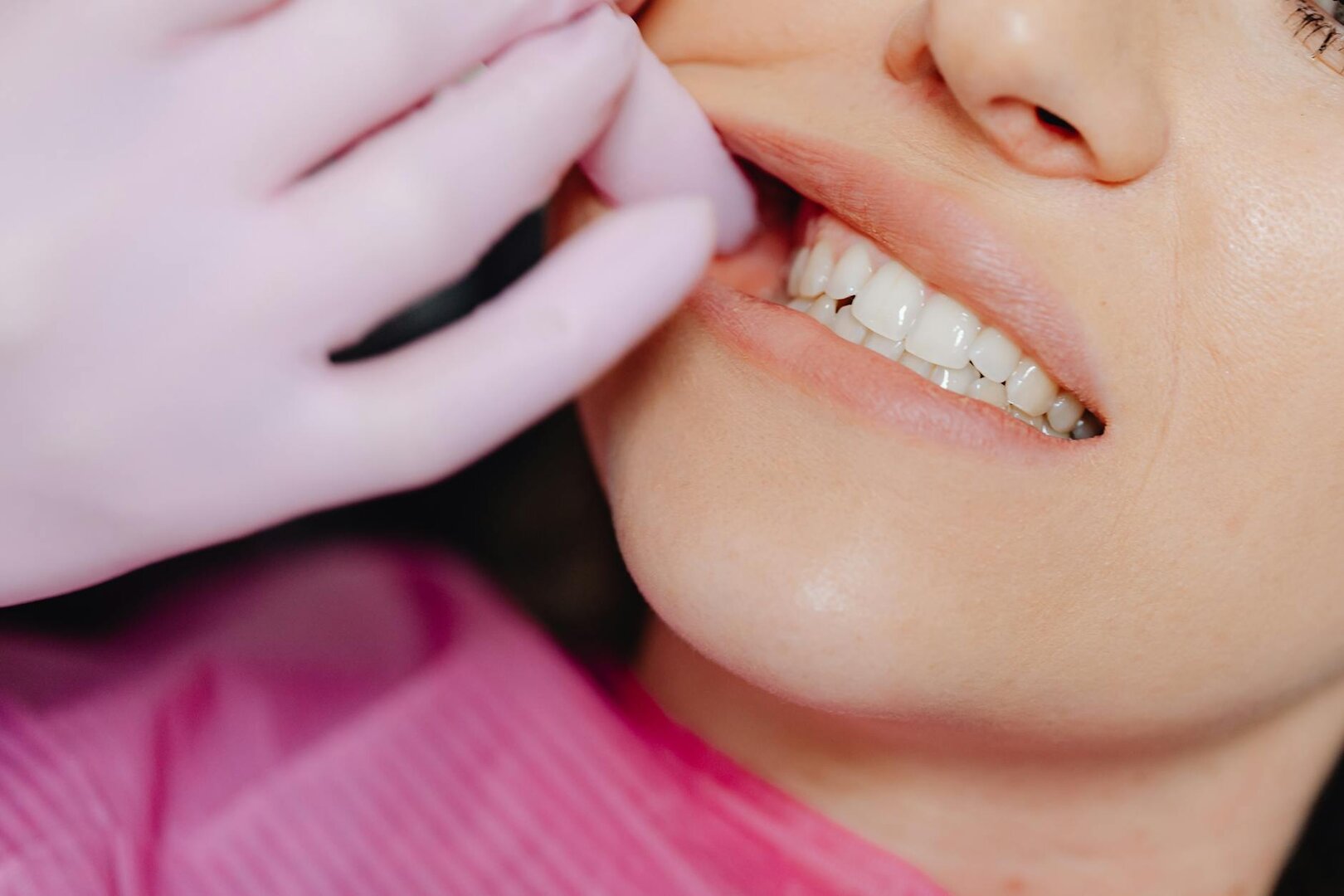 Primer plano de sonrisa durante una valoración estética y funcional de la zona mandibular